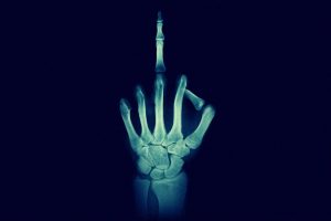Mittelfinger beim Röntgen