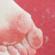 Fußpilz auch nicht schlimmer als ein normales Jucken am Fuß – Coronaskeptiker plant für Schwimmbadsaison